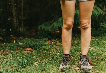 Wound on the knee
